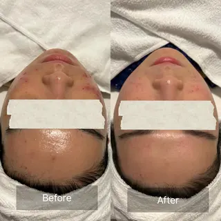 【美肌・脱毛専門店】 SARA 恵比寿店のエステ・リラクイメージ