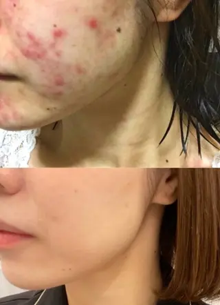 シミ・肌育サロン Jullyのエステ・リラクイメージ