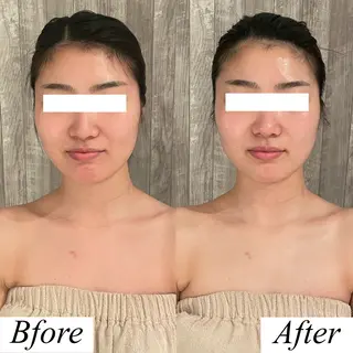 グレースフィオーレ上野御徒町店所属・頭蓋骨小顔矯正 上野御徒町店＊かんなのエステ・リラクイメージ