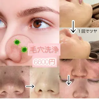 laluna saki...のその他イメージ