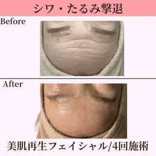 Belle White所属・本格痩身＊透明美肌 BelleWhiteのエステ・リラクイメージ