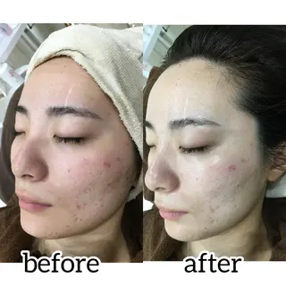 laluna saki...のその他イメージ