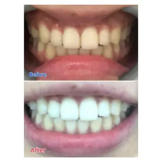 MBEAUTYSALON 千葉店・京成大久保所属・Melty 輝のその他イメージ