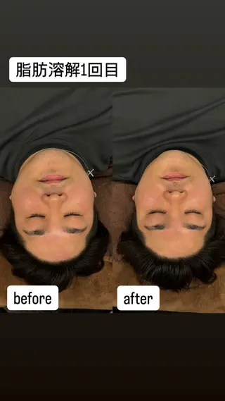 Micell beauty所属・Micell beautyのエステ・リラクイメージ