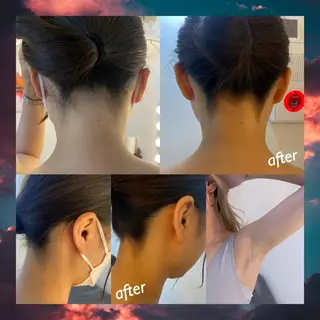 うなじ脱毛/美肌脱毛 LABELのエステ・リラクイメージ