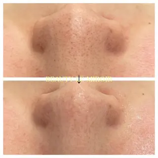 ビューティー ミロワールのエステ・リラクイメージ