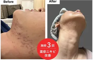 脂肪冷却/エステ COCOKARAのエステ・リラクイメージ