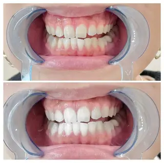 ロング ヘアアレンジ ネイル マツエク・マツパ メンズ カラー パーマ キッズ アイブロウ ライトビューティー 銀座店のエステ・リラクイメージ