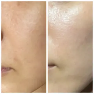 salon ace所属・【小顔矯正】 salonaceのエステ・リラクイメージ