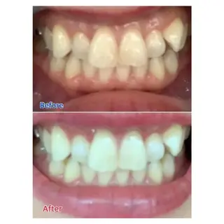 M渋谷店所属・M渋谷 ホワイトニングのエステ・リラクイメージ