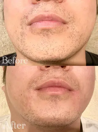 メンズ 沖 美麗のエステ・リラクイメージ