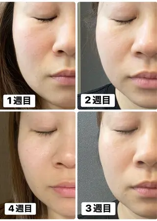 ナリス化粧品De I’mあべのルシアス所属・山本 紗織のエステ・リラクイメージ