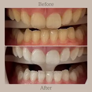 ホワイトニングサロン SARAのエステ・リラクイメージ