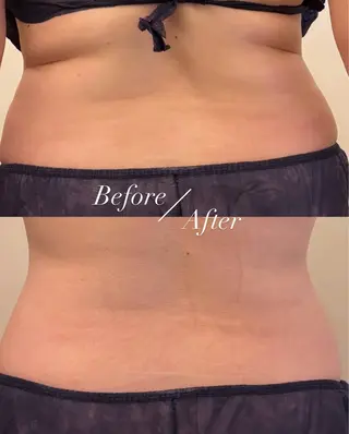 Ellebeauty relaxationのエステ・リラクイメージ