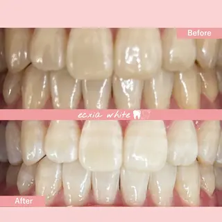 セルフホワイトニング エクシア中島公園店のその他イメージ