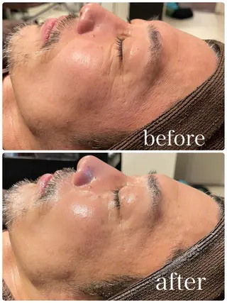 メンズ アイブロウ ヤスダ ユウコのエステ・リラクイメージ