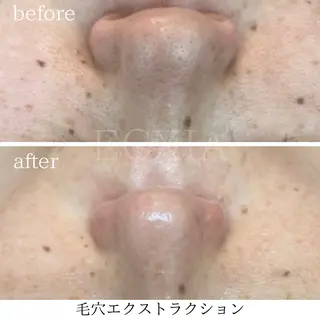 ECXIA 【エクシア】のエステ・リラクイメージ