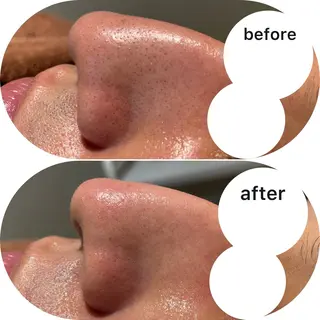 脱毛&エステサロン JIGGLY☆松田のエステ・リラクイメージ