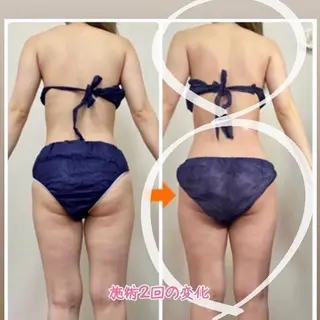 ネイル ‍痩身＆ボディ 結果出し🌟丹野のエステ・リラクイメージ