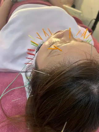 美容鍼灸女性専用 りんご鍼灸治療院のエステ・リラクイメージ