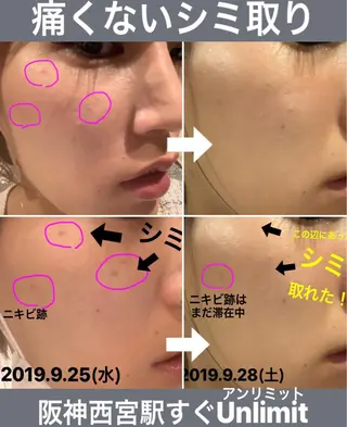 脱毛＆エステサロン【アンリミット】所属・森谷 莉美のエステ・リラクイメージ