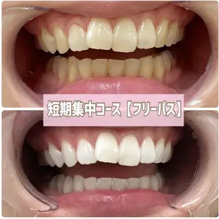 ホワイトニングサロン BE WHITE金山のその他イメージ