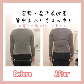 小顔モニター 募集のエステ・リラクイメージ