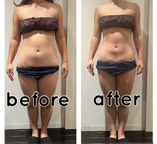 脱毛フェイシャル痩身 エリア最安👑永野舞のエステ・リラクイメージ