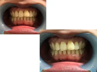 ミディアム ヘアアレンジ ネイル マツエク・マツパ メンズ カラー パーマ キッズ アイブロウ 中目黒 ホワイトニングサロンのその他イメージ