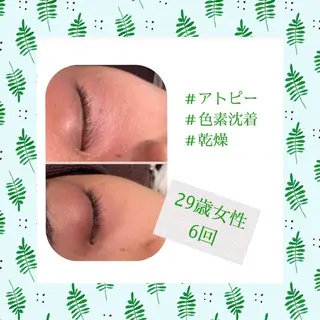 ミディアム カラー パーマ ヘアアレンジ メンズ キッズ ネイル マツエク・マツパ ニキビ・肌質改善専門 ♡人生が変わるサロンのエステ・リラクイメージ