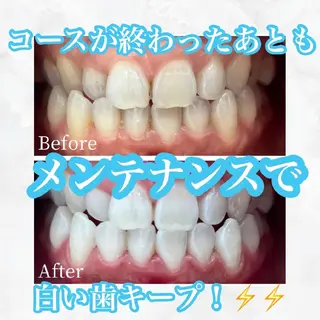 メンズ キッズ セルフホワイトニング WHITE福岡博多店のエステ・リラクイメージ