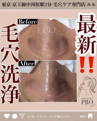 LULU所属・LULU ルルのエステ・リラクイメージ