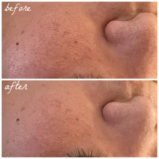 メンズ メナード岐阜市茜部 杉浦のエステ・リラクイメージ