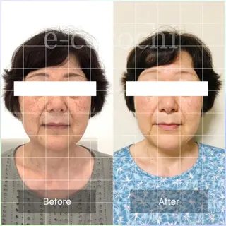 小顔と ヘッドスパのお店のエステ・リラクイメージ