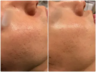 B U B 立川のエステ・リラクイメージ