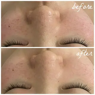 メンズ メナード岐阜茜部 杉浦のエステ・リラクイメージ