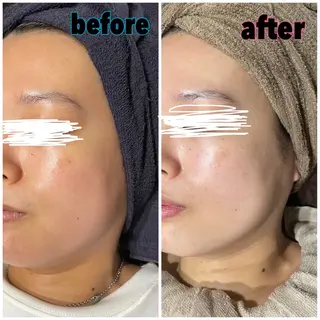 EARTH coiffure beaute 小山店所属・EARTH 小山店 shimaのエステ・リラクイメージ