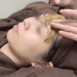 ニキビ改善シャルム ココハーブピーリングのエステ・リラクイメージ