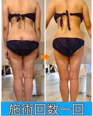 ロング カラー パーマ ヘアアレンジ メンズ キッズ ネイル マツエク・マツパ ‍痩身＆ボディ 結果出し🌟丹野のエステ・リラクイメージ