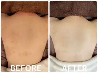 ハーブピーリング 横浜のエステ・リラクイメージ