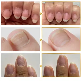 ネイル 小林 ゆりあのネイルデザイン