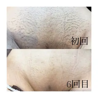 温活beautyサロンNeroli所属・切らない脂肪吸引🔥 Neroliまりこのエステ・リラクイメージ