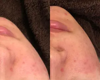 Embellier所属・Embellier ★のエステ・リラクイメージ