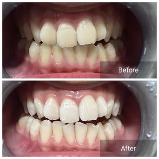 セルフホワイトニング サクッとホワイト   立川店所属・サクッとホワイト 立川店のその他イメージ