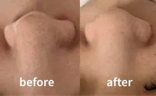 Lueur(リュール)所属・小田急線鶴川駅 Lueurリュールのエステ・リラクイメージ