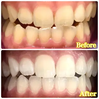 LOVE ホワイトニング渋谷のその他イメージ