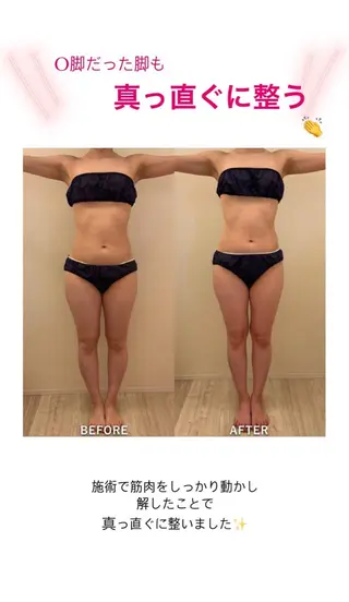 産後ダイエット−9㎏ Pourvous結衣のエステ・リラクイメージ