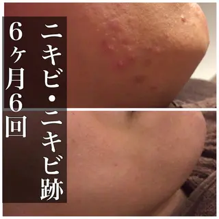 ミディアム カラー パーマ ヘアアレンジ メンズ キッズ ネイル マツエク・マツパ ニキビ・肌質改善専門 ♡人生が変わるサロンのエステ・リラクイメージ