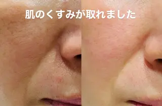 mire（ミレ） トータルビューティーのエステ・リラクイメージ