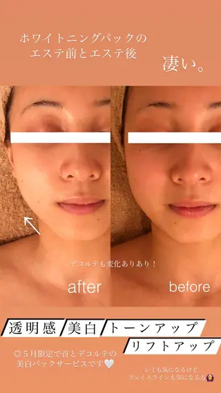 高岡⌇ Ayaka🌻のエステ・リラクイメージ